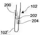 Fig. 01 - Determining inserted catheter end location and orientation