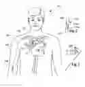 Fig. 02 - Determining inserted catheter end location and orientation