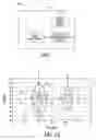 Fig. 04 - Ischemia detection using heart sound timing