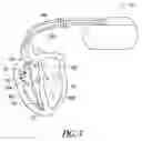 Fig. 06 - Ischemia detection using heart sound timing