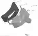 Fig. 06 - Urine specimen collection device