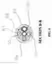 Fig. 07 - Non-contact tissue ablation device and methods thereof
