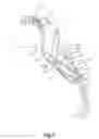 Fig. 04 - ORTHOTIC DEVICE FOR AN ANIMAL