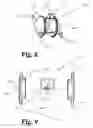 Fig. 06 - Devices and methods for body fluid flow control in extracorporeal fluid treatment