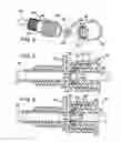 Fig. 03 - CATHETER INTRODUCER SYSTEM