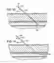Fig. 07 - CATHETER INTRODUCER SYSTEM