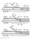 Fig. 09 - CATHETER INTRODUCER SYSTEM