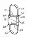Fig. 01 - Methods and systems for laterally stabilized constraint of spinous processes