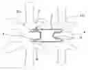 Fig. 01 - Interspinous process distraction device