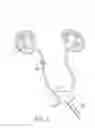 Fig. 02 - Methods for removing kidney stones from the ureter