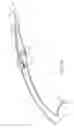 Fig. 07 - Methods for removing kidney stones from the ureter