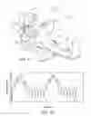 Fig. 02 - Method for Depositing Radiation in Heart Muscle