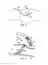 Fig. 03 - ROBOTIC MEDICAL INSTRUMENT SYSTEM