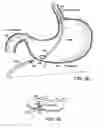 Fig. 06 - ROBOTIC MEDICAL INSTRUMENT SYSTEM