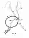 Fig. 09 - ROBOTIC MEDICAL INSTRUMENT SYSTEM