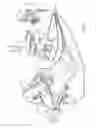 Fig. 02 - Robotically controlled medical instrument