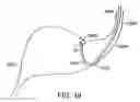 Fig. 49 - Robotically controlled medical instrument