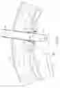 Fig. 06 - Remote Suturing Device