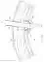 Fig. 14 - Remote Suturing Device