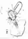 Fig. 02 - Surgical device having trocar and associated methods