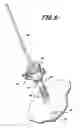 Fig. 09 - Surgical device having trocar and associated methods