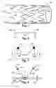 Fig. 02 - APPARATUS AND METHOD FOR ANCHORING A PROSTHETIC STRUCTURE TO A BODY TISSUE