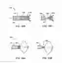 Fig. 33 - APPARATUS FOR GRASPING AND CINCHING TISSUE ANCHORS