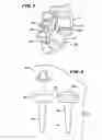 Fig. 02 - FACET ARTHROPLASTY DEVICES AND METHODS
