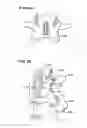 Fig. 09 - FACET ARTHROPLASTY DEVICES AND METHODS