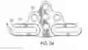 Fig. 09 - Modular occipital plate