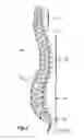 Fig. 02 - Polyaxial adjustment of facet joint prostheses