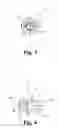 Fig. 03 - Adjustable jacking implant