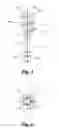 Fig. 04 - Adjustable jacking implant