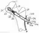 Fig. 01 - Screw and method of use