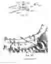 Fig. 09 - Screw and method of use