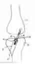 Fig. 01 - Fixation device for surgical repair