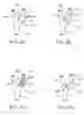 Fig. 06 - ELECTRODE CONTACT CONFIGURATIONS FOR CUFF LEADS
