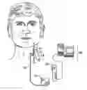 Fig. 01 - Method and apparatus for integrating implantable medical device data