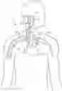 Fig. 01 - ELECTRODE CONTACT CONFIGURATIONS FOR AN IMPLANTABLE STIMULATOR