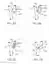 Fig. 06 - ELECTRODE CONTACT CONFIGURATIONS FOR AN IMPLANTABLE STIMULATOR