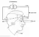 Fig. 01 - Device for Treating Human Vision Using Combined Optical and Electrical Stimulation
