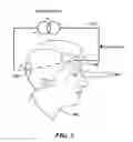 Fig. 03 - Device for Treating Human Vision Using Combined Optical and Electrical Stimulation