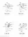 Fig. 06 - CUFF ELECTRODE ARRANGEMENT FOR NERVE STIMULATION AND METHODS OF TREATING DISORDERS