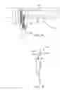 Fig. 10 - CUFF ELECTRODE ARRANGEMENT FOR NERVE STIMULATION AND METHODS OF TREATING DISORDERS