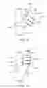 Fig. 16 - CUFF ELECTRODE ARRANGEMENT FOR NERVE STIMULATION AND METHODS OF TREATING DISORDERS