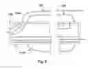 Fig. 05 - Treatment device for treating a side branch of a vessel and method for positioning a stent in a side branch
