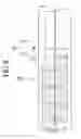 Fig. 09 - STENT SUPPLY INSTRUMENT