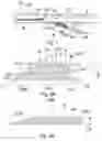 Fig. 02 - Device and method for supporting a side branch of a vessel