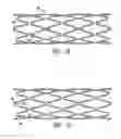 Fig. 07 - Stent with cover connectors