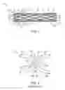 Fig. 02 - Stent With Improved Flexibility and Method for Making Same